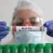 FILE PHOTO: A person holds a test tube labelled "Bird Flu", in this picture illustration, January 14, 2023. REUTERS/Dado Ruvic/Illustration